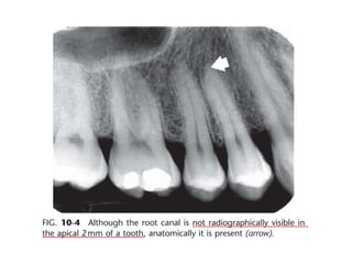 Intraoral radiographic anatomy