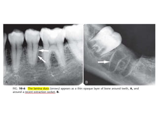 Intraoral radiographic anatomy