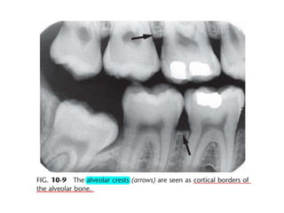 Intraoral radiographic anatomy