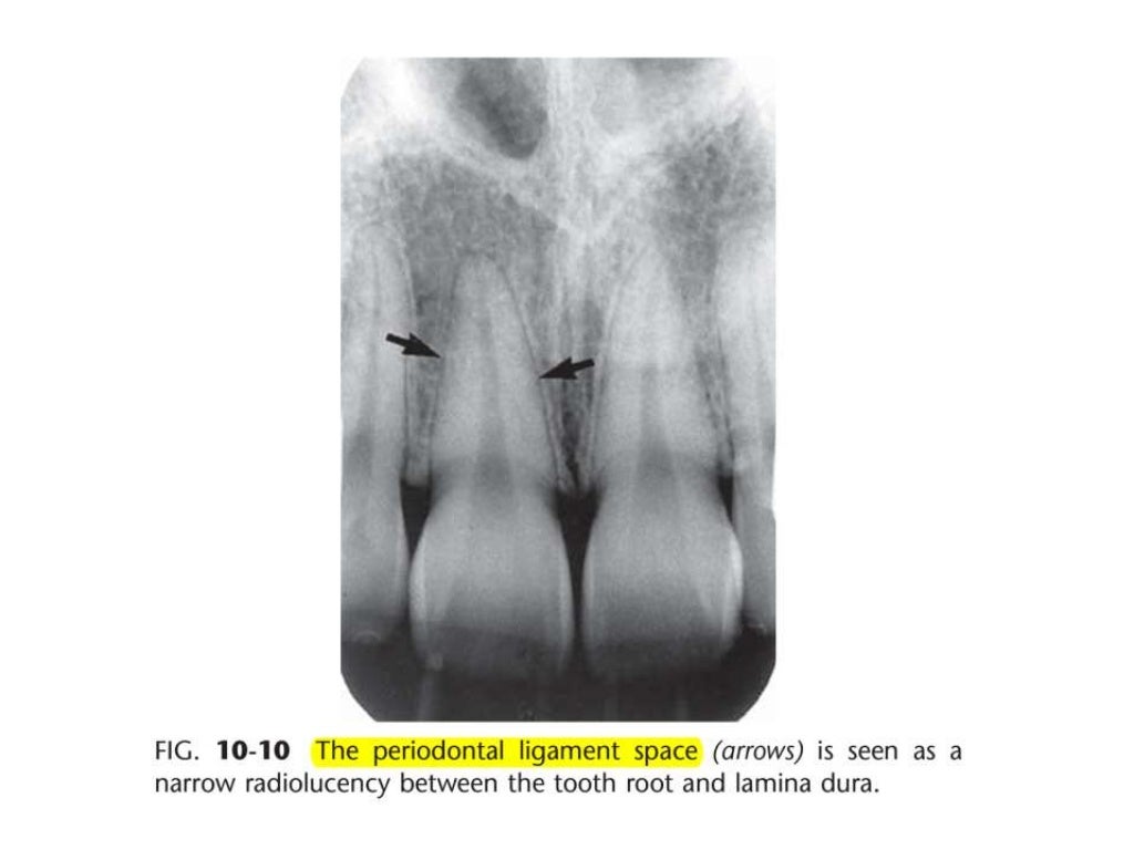Intraoral radiographic anatomy