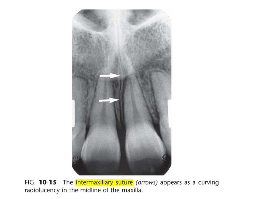 Intraoral radiographic anatomy