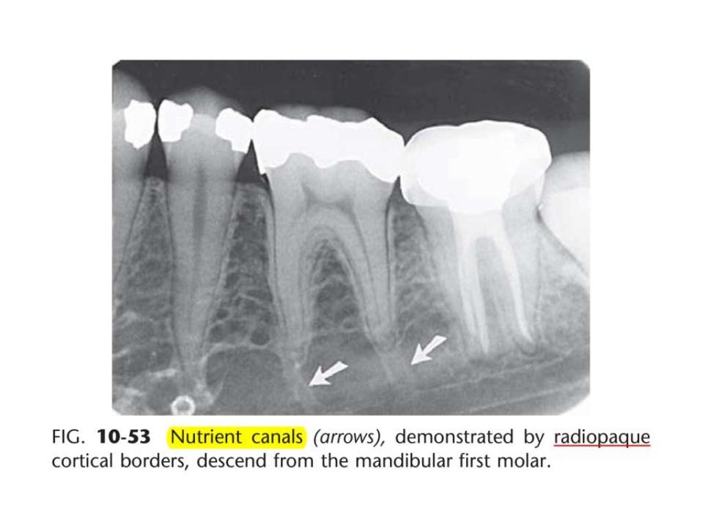Intraoral radiographic anatomy