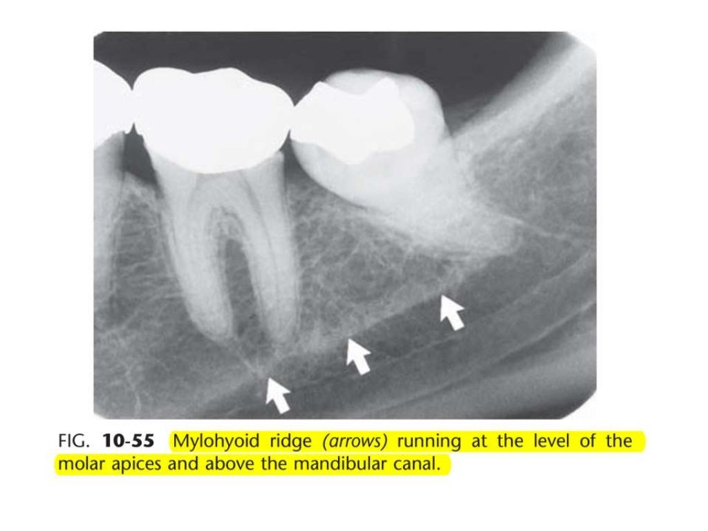 Intraoral radiographic anatomy