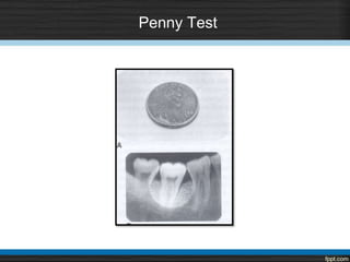 Penny Test
 