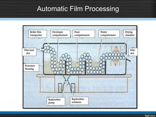 Automatic Film Processing
Roller film
transporter
Developer
compartement
Film feed
slot
Processor
Housing
Fixer
compartement
Water
compartement
Drying
chamber
Film
slot
Replenisher
pump
Replenisher
solutions
 