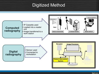 Digitized Method
• IP Cassette used
• Loaded into a reader
unit
• Image transferred to a
work station
Computed
radiography
• Sensor used
• Connected to
workstation
Digital
radiography
 