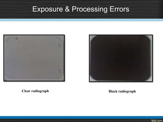 Exposure & Processing Errors
Clear radiograph Black radiograph
 