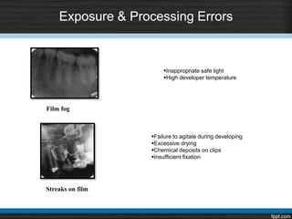 Exposure & Processing Errors
Streaks on film
Film fog
Inappropriate safe light
High developer temperature
Failure to agitate during developing
Excessive drying
Chemical deposits on clips
Insufficient fixation
 