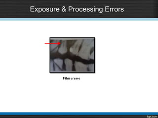 Film crease
Exposure & Processing Errors
 
