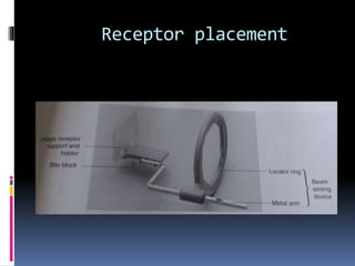 Receptor placement
 