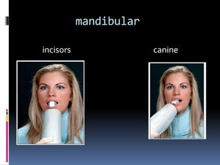 mandibular
incisors canine
 
