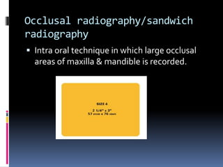 Occlusal radiography/sandwich
radiography
 Intra oral technique in which large occlusal
areas of maxilla & mandible is recorded.
 