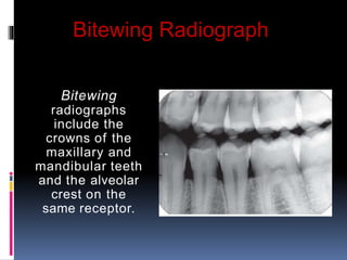 Intraoral_Radiography_Part_1.pptx for bds | PPTX