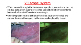 Comprehensive Overview of Intraoral Scanners and Digital Dental ...