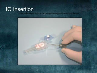 IO Insertion
Place the stylet into an approved biological hazard container
 