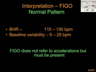 Intra Partum Cardiotocography - dr vivek patkar | PPT