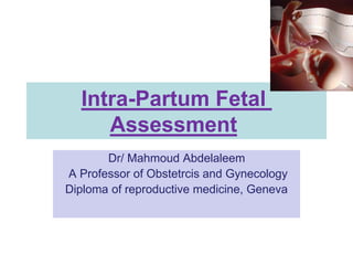 Intra-Partum Fetal
Assessment
Dr/ Mahmoud Abdelaleem
A Professor of Obstetrcis and Gynecology
Diploma of reproductive medicine, Geneva
 