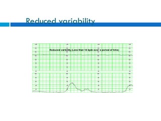 Comprehensive Guide to Intrapartum Fetal Heart Rate Monitoring and ...