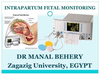 INTRAPARTUM FETAL MONITORING




   DR MANAL BEHERY
 Zagazig University, EGYPT
 
