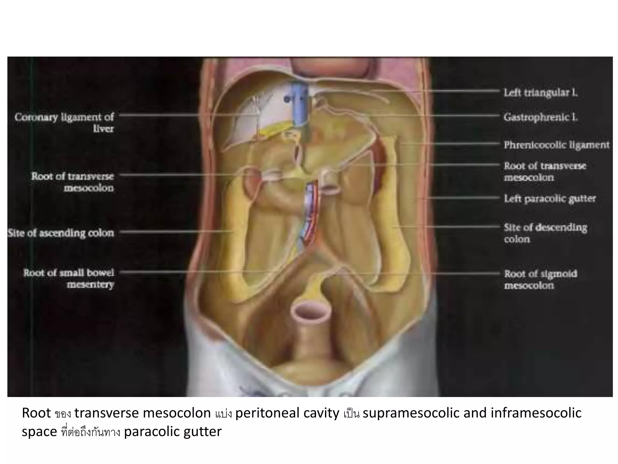 Root ของ transverse mesocolon แบ่ง peritoneal cavity เป็น supramesocolic and inframesocolic
space ที่ต่อถึงกันทาง paracolic gutter
 
