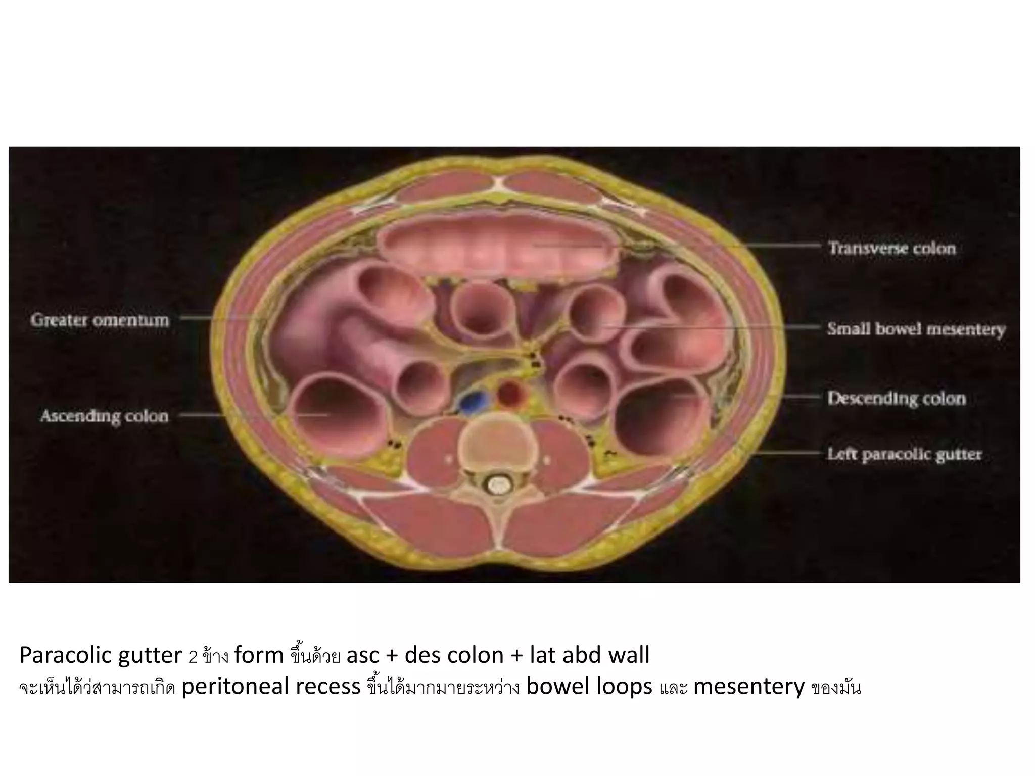 Paracolic gutter 2 ข้าง form ขึ้นด้วย asc + des colon + lat abd wall
จะเห็นได้ว่สามารถเกิด peritoneal recess ขึ้นได้มากมายระหว่าง bowel loops และ mesentery ของมัน
 