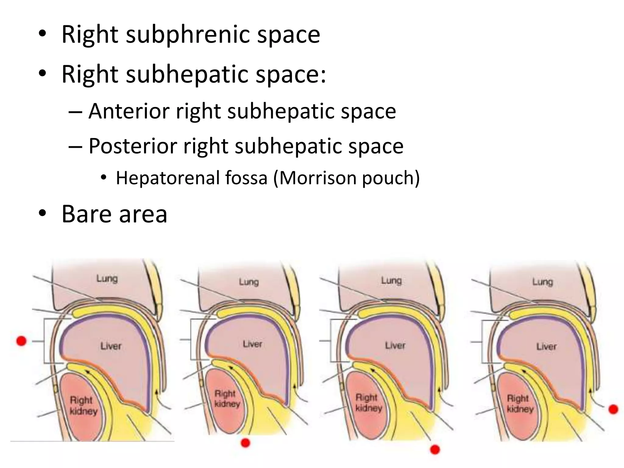 • Right subphrenic space
• Right subhepatic space:
– Anterior right subhepatic space
– Posterior right subhepatic space
• Hepatorenal fossa (Morrison pouch)
• Bare area
 