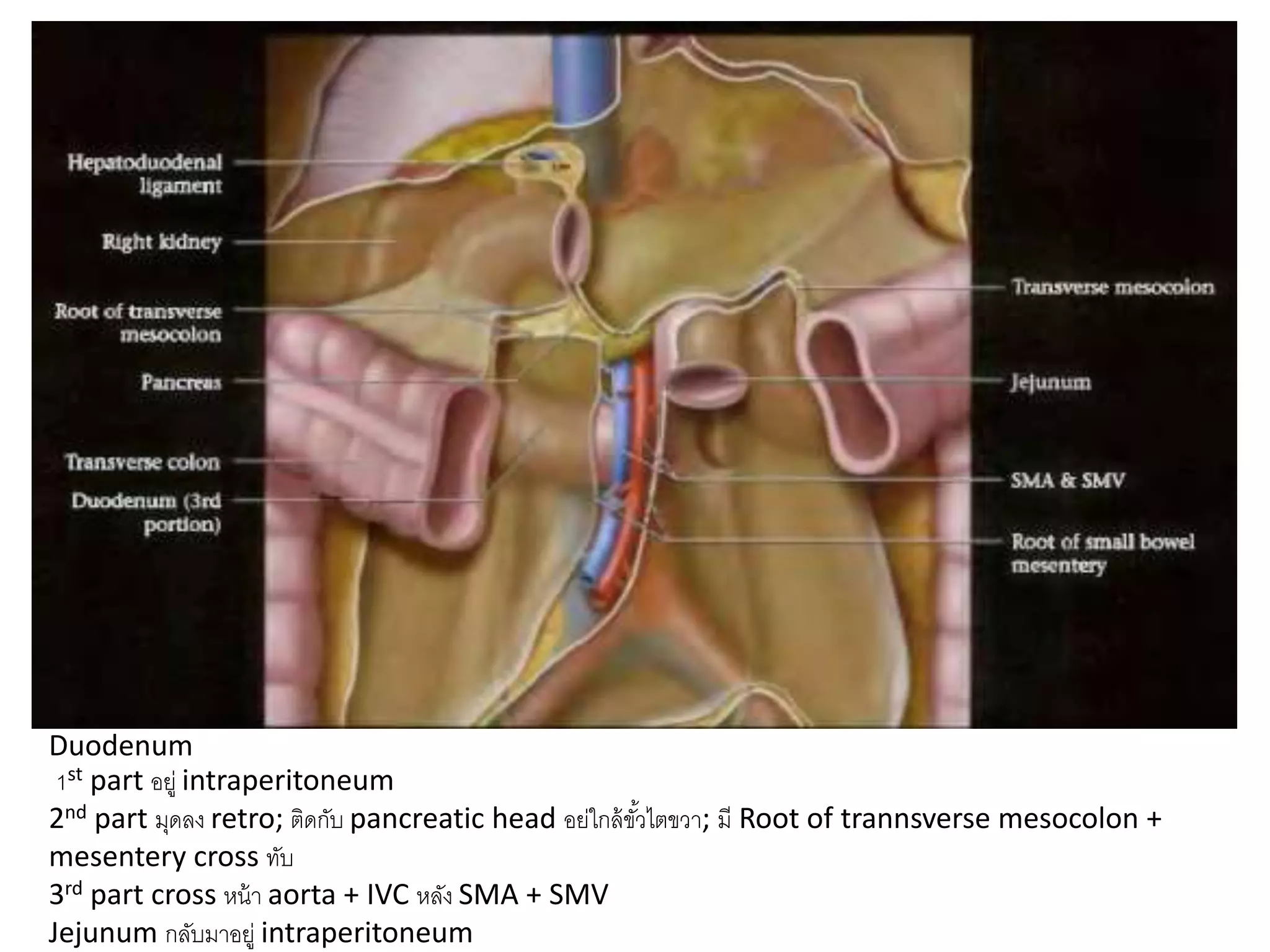 Duodenum
1st part อยู่ intraperitoneum
2nd part มุดลง retro; ติดกับ pancreatic head อย่ใกล้ขั้วไตขวา; มี Root of trannsverse mesocolon +
mesentery cross ทับ
3rd part cross หน้า aorta + IVC หลัง SMA + SMV
Jejunum กลับมาอยู่ intraperitoneum
 