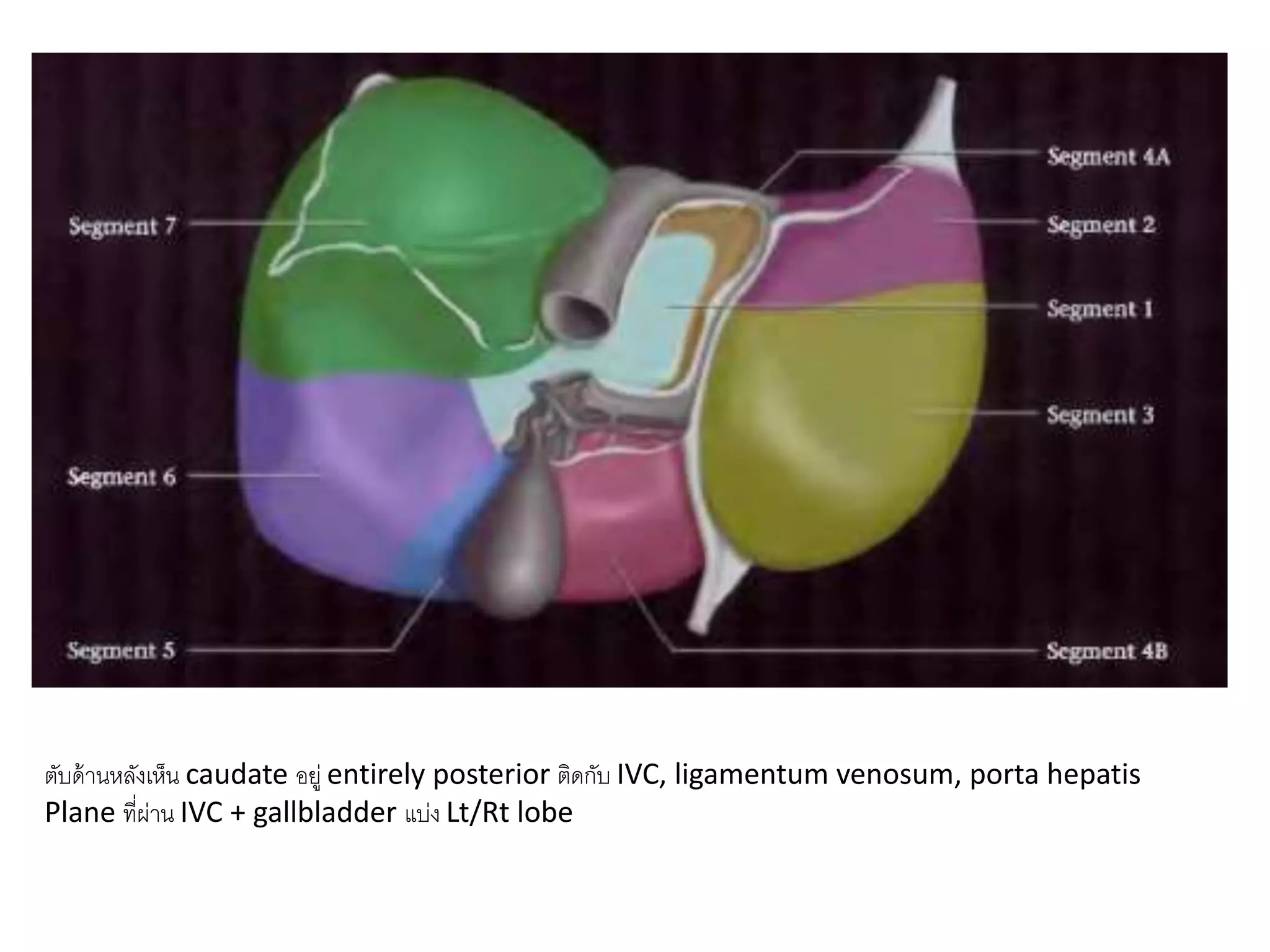 ตับด้านหลังเห็น caudate อยู่ entirely posterior ติดกับ IVC, ligamentum venosum, porta hepatis
Plane ที่ผ่าน IVC + gallbladder แบ่ง Lt/Rt lobe
 