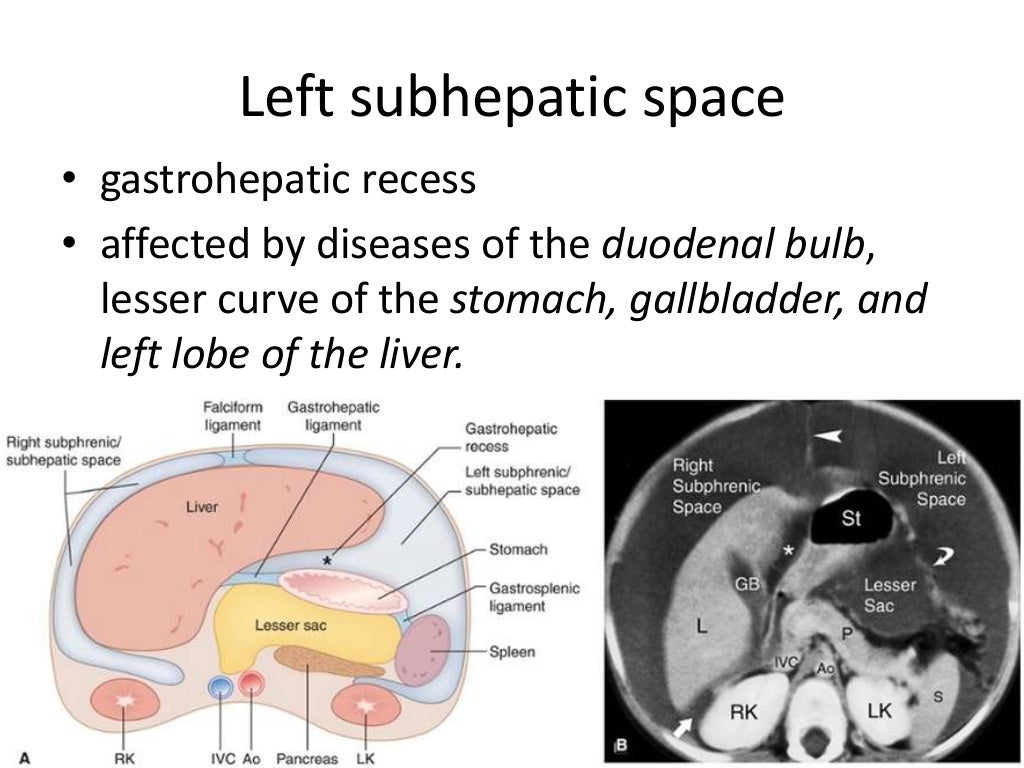 Intraperitoneal anatomy