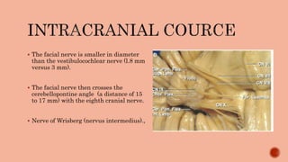 Intratemporal course ofnerve PPTX