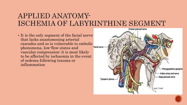 Intratemporal course ofnerve Intratemporal course ofnerve