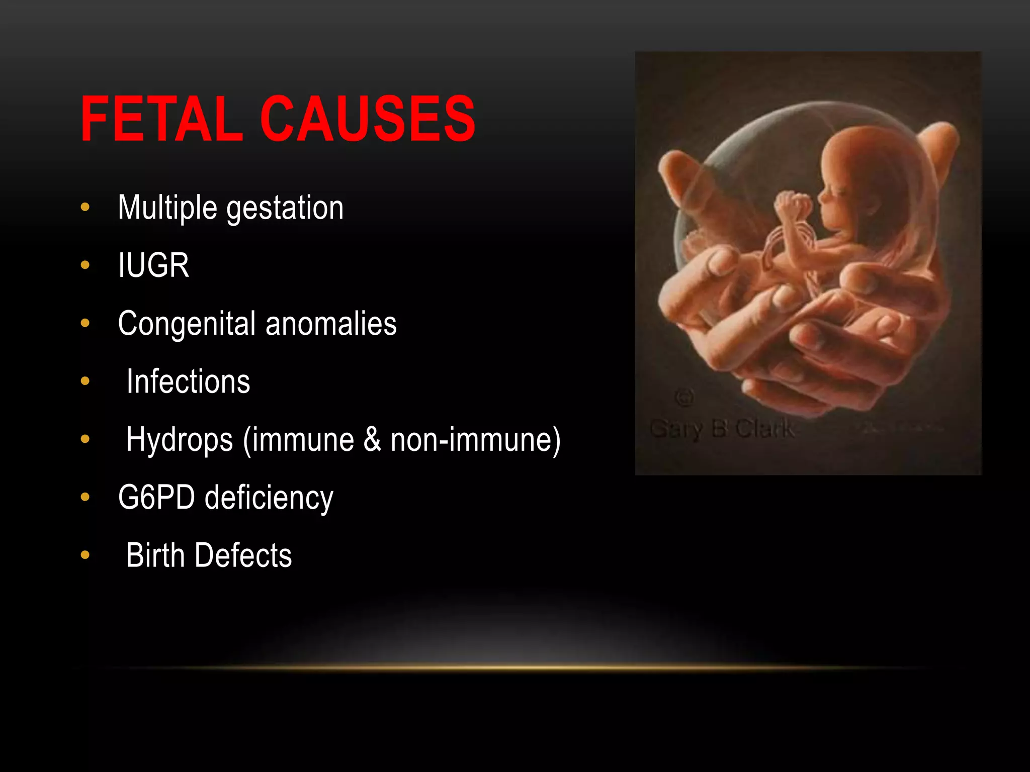 FETAL CAUSES
• Multiple gestation
• IUGR
• Congenital anomalies
• Infections
• Hydrops (immune & non-immune)
• G6PD deficiency
• Birth Defects
 