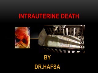BY
DR.HAFSA
INTRAUTERINE DEATH
 
