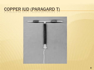 COPPER IUD (PARAGARD T)
4
 