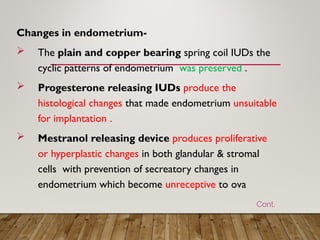 Spring Iud INTRAUTERINE DEVICES INCLUDING LNG-IUD.PPT