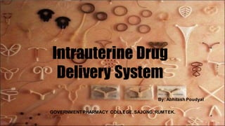 Intrauterine Drug
Delivery System
By: Abhilash Poudyal
GOVERNMENT PHARMACY COLLEGE,SAJONG,RUMTEK.
 