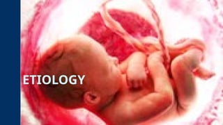 ETIOLOGY
 