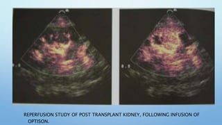 INTRAVASCULAR CONTRAST MEDIA [Autosaved].pptx