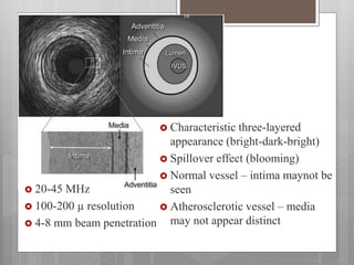  Characteristic three-layered
appearance (bright-dark-bright)
 Spillover effect (blooming)
 Normal vessel – intima maynot be
seen
 Atherosclerotic vessel – media
may not appear distinct
 20-45 MHz
 100-200 µ resolution
 4-8 mm beam penetration
16
 