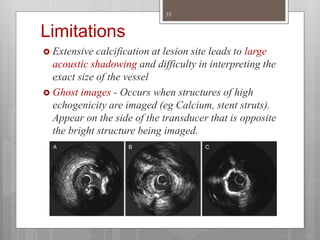 Limitations
 Extensive calcification at lesion site leads to large
acoustic shadowing and difficulty in interpreting the
exact size of the vessel
 Ghost images - Occurs when structures of high
echogenicity are imaged (eg Calcium, stent struts).
Appear on the side of the transducer that is opposite
the bright structure being imaged.
33
 