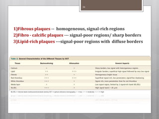 1)Fibrous plaques -- homogeneous, signal-rich regions
2)Fibro - calcific plaques --- signal-poor regions/ sharp borders
3)Lipid-rich plaques ---signal-poor regions with diffuse borders
39
 