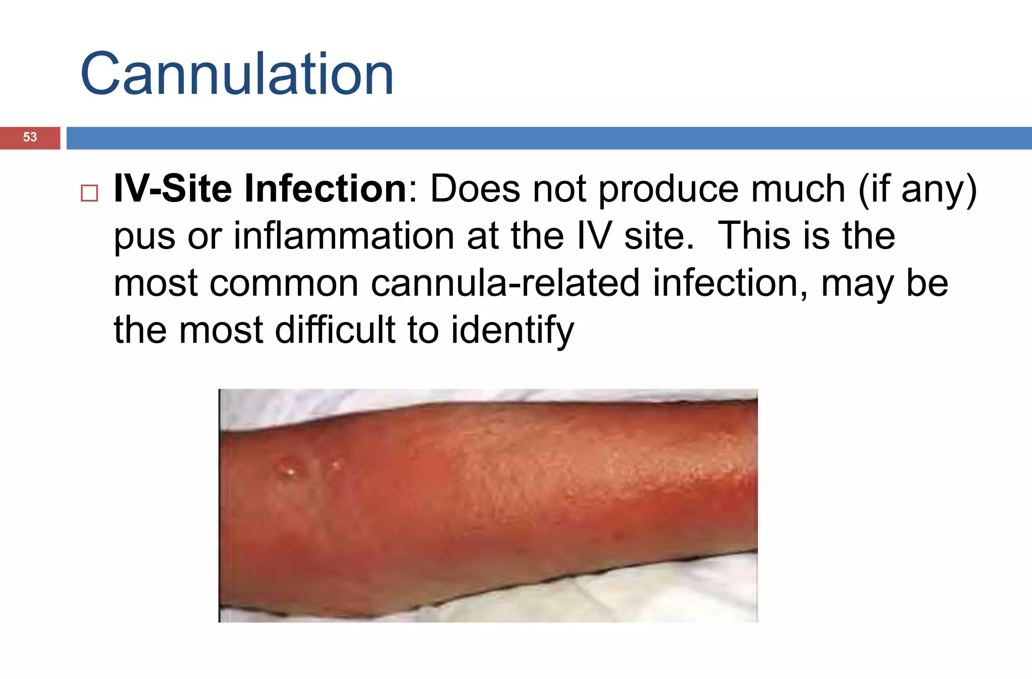 Cannulation
 IV-Site Infection: Does not produce much (if any)
pus or inflammation at the IV site. This is the
most common cannula-related infection, may be
the most difficult to identify
53
 