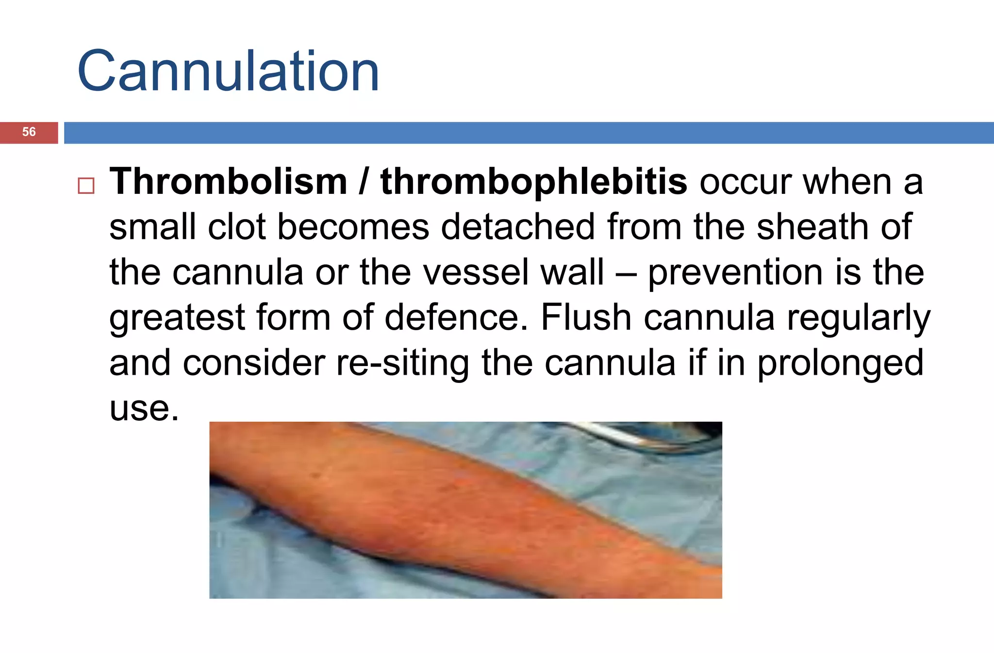 Cannulation
 Thrombolism / thrombophlebitis occur when a
small clot becomes detached from the sheath of
the cannula or the vessel wall – prevention is the
greatest form of defence. Flush cannula regularly
and consider re-siting the cannula if in prolonged
use.
56
 