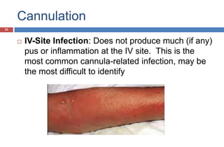 Cannulation
 IV-Site Infection: Does not produce much (if any)
pus or inflammation at the IV site. This is the
most common cannula-related infection, may be
the most difficult to identify
53
 