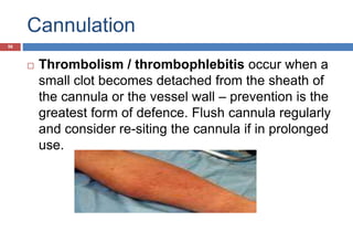 Cannulation
 Thrombolism / thrombophlebitis occur when a
small clot becomes detached from the sheath of
the cannula or the vessel wall – prevention is the
greatest form of defence. Flush cannula regularly
and consider re-siting the cannula if in prolonged
use.
56
 