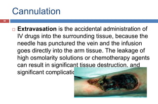 Cannulation
 Extravasation is the accidental administration of
IV drugs into the surrounding tissue, because the
needle has punctured the vein and the infusion
goes directly into the arm tissue. The leakage of
high osmolarity solutions or chemotherapy agents
can result in significant tissue destruction, and
significant complications
58
 