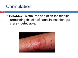 Cannulation
 Cellulites:  Warm, red and often tender skin
surrounding the site of cannula insertion; pus
is rarely detectable.
21
 