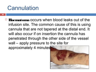 Cannulation
 Haematoma occurs when blood leaks out of the
infusion site. The common cause of this is using
cannula that are not tapered at the distal end. It
will also occur if on insertion the cannula has
penetrated through the other side of the vessel
wall – apply pressure to the site for
approximately 4 minutes and elevate the limb
27
 