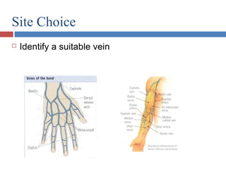 Site Choice
 Identify a suitable vein
 
