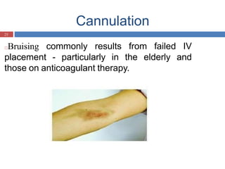 Cannulation
25
□Bruising commonly results from failed IV
placement - particularly in the elderly and
those on anticoagulant therapy.
 